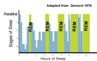 rem_stages.jpg (29105 bytes)